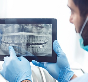 Dental x-rays on tablet computer