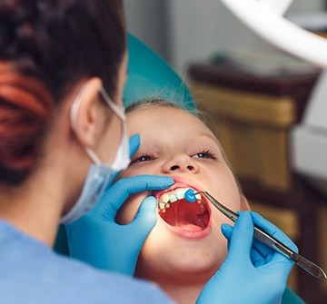 Pediatric dentist in Pelham applying fluoride treatment
