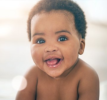 Baby laughing after laser frenectomy treatment