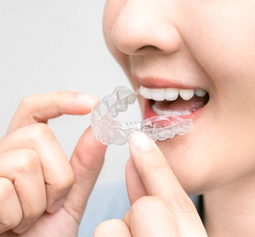 A person preparing to insert a clear tray into her mouth as part of treatment with Invisalign in Pelham
