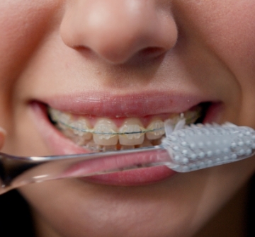 a kid with braces brushing their teeth 
