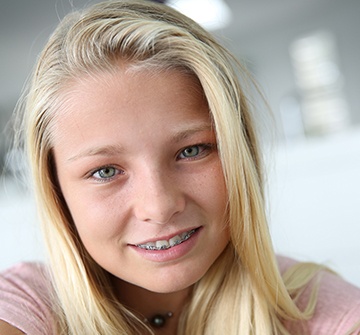 Preteen girl with phase one orthodontics