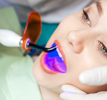 Closeup of patient receiving dental sealants