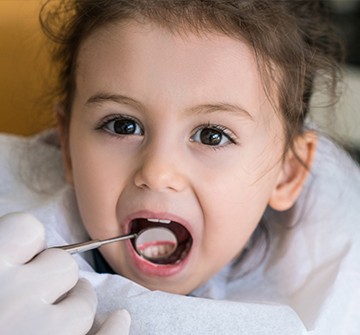 Toddler's repaired smile after tooth colored fillings