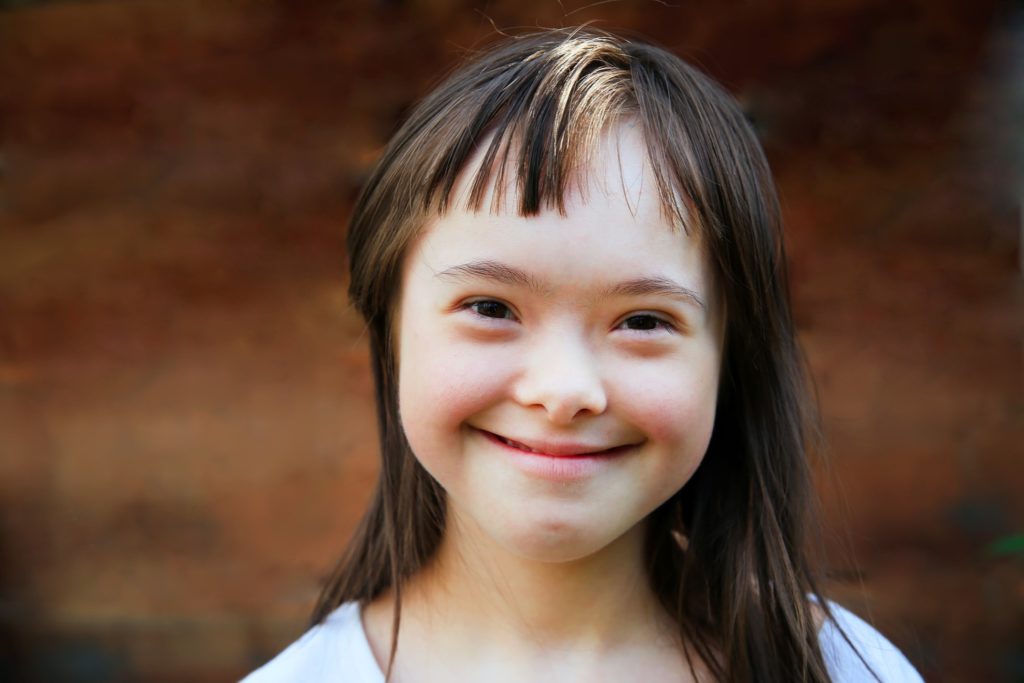 Closeup of child with down syndrome smiling