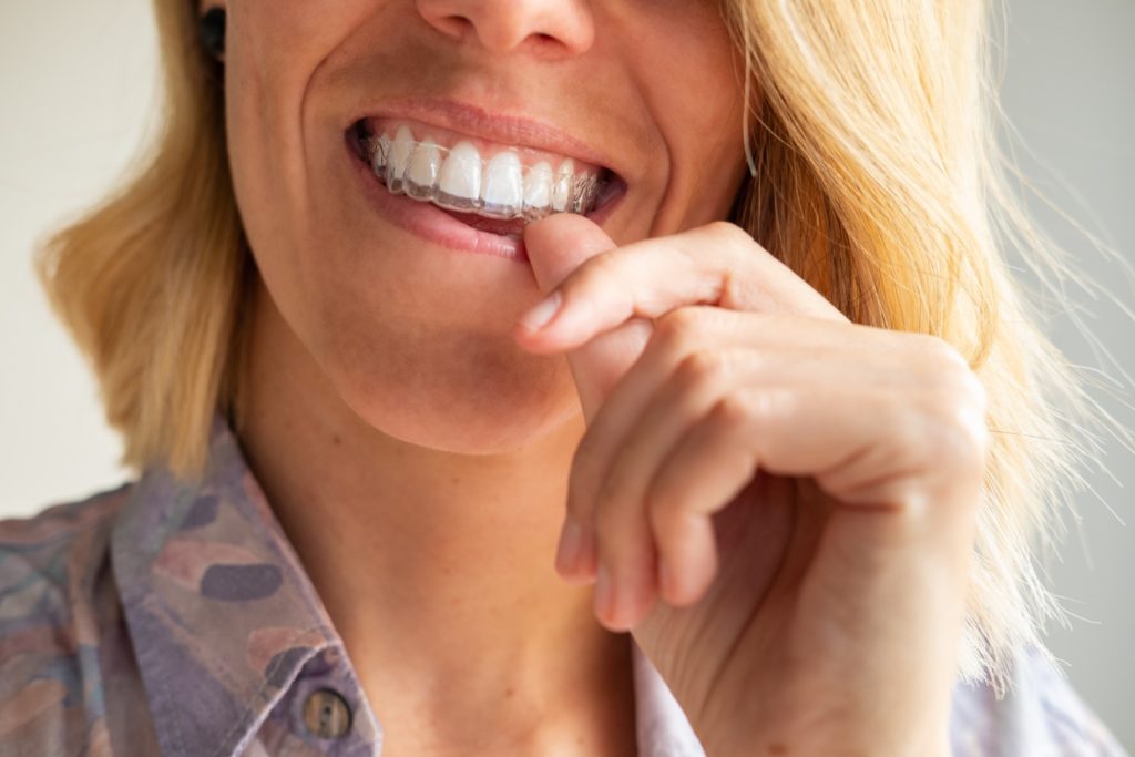 Woman putting on Invisalign clear aligner